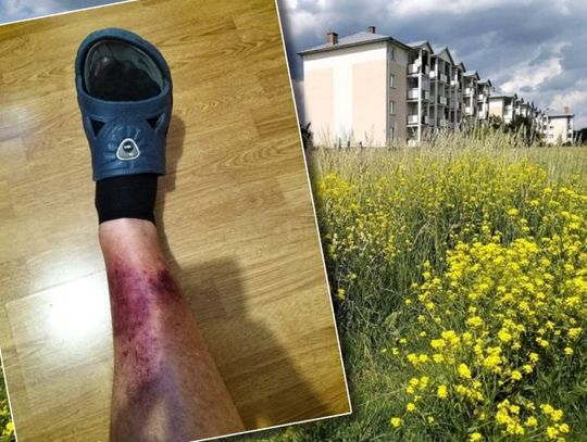 Chełm. Na działce obok osiedla trawa sięga prawie 170 cm