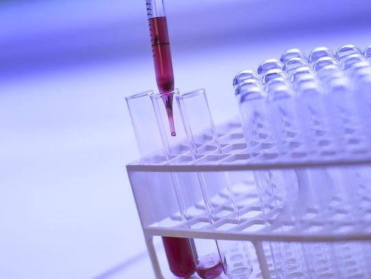 Łóżka czekają na korona-podejrzanych