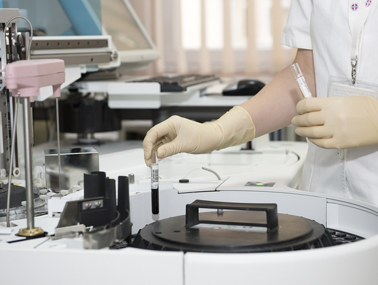 Szpital zaprasza na badania | Super Tydzień