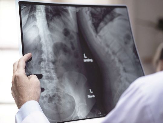 Szykuje się strajk techników radiologów