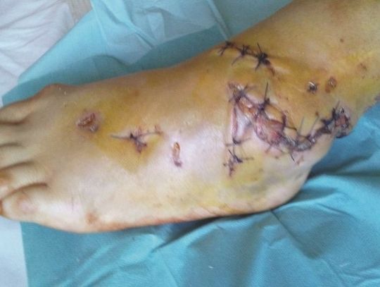 Właściciel agresywnych psów stanie przed sądem