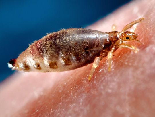 Wszy w natarciu! | Super Tydzień