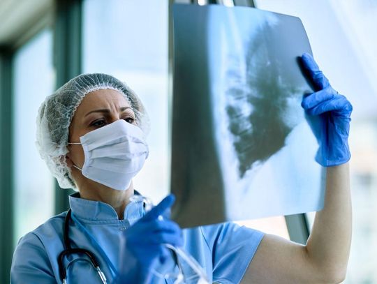 Zamojski Szpital Niepubliczny poszukuje pulmonologów, internistów i ordynatora oddziału chorób płuc