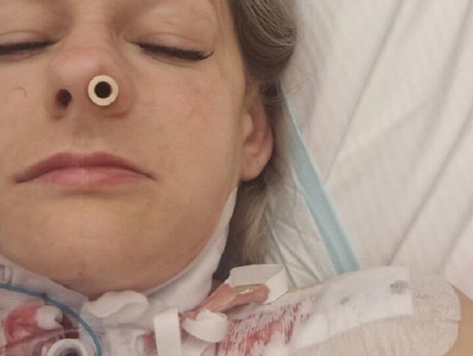 Krasnystaw. Operacja uratowała pani Katarzynie życie, teraz potrzebna jest nasza pomoc