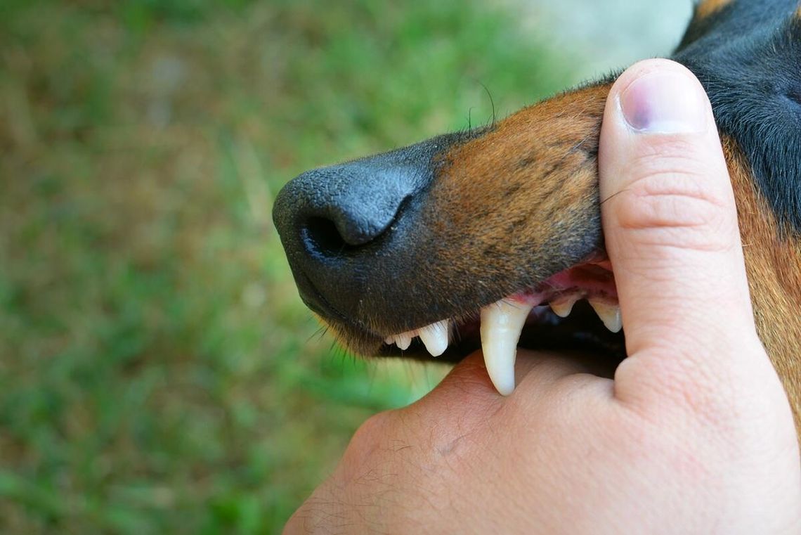 70-latek pogryziony przez psy w Żółkiewce Osadzie. Trwa policyjne dochodzenie