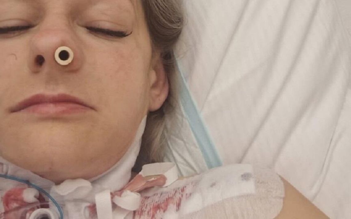 Krasnystaw. Operacja uratowała pani Katarzynie życie, teraz potrzebna jest nasza pomoc