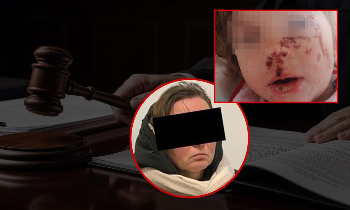 Oblewała córkę kwasem, by zakładać zbiórki na jej leczenie. Monika B. skazana
